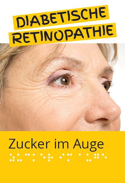 Cover: Diabetische Retinopathie. Ein Frauengesicht mit Fokus auf die Augenpartie